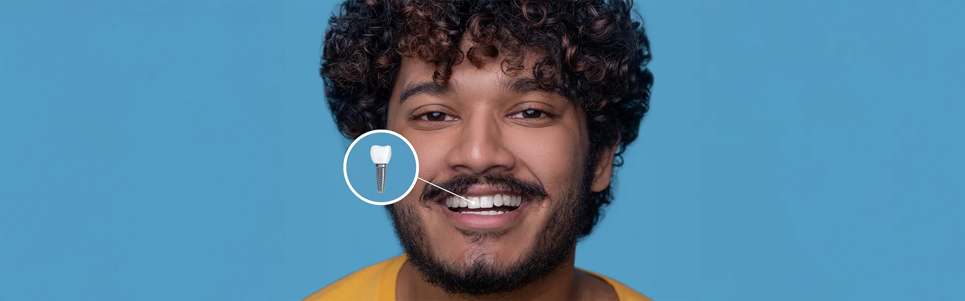 Missing Teeth? Discover Why Dental Implants Are the Best Solution